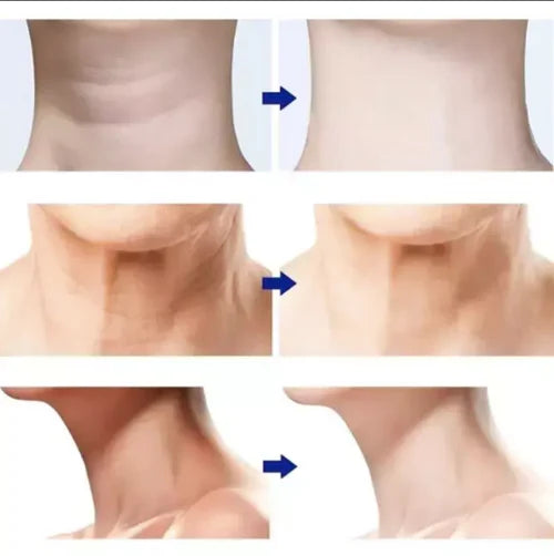 MASAJEADOR FACIAL REDUCTOR DE ARRUGAS