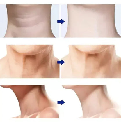 MASAJEADOR FACIAL REDUCTOR DE ARRUGAS
